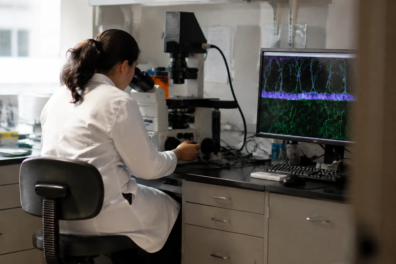 Microvascular Histology of the Diabetic Donor Retina