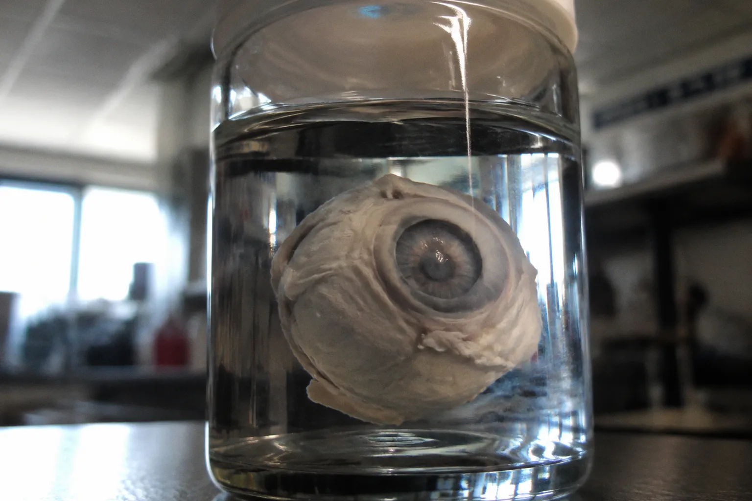 Photoreceptor Death vs Post-Mortem Artifacts in Donor Eyes
