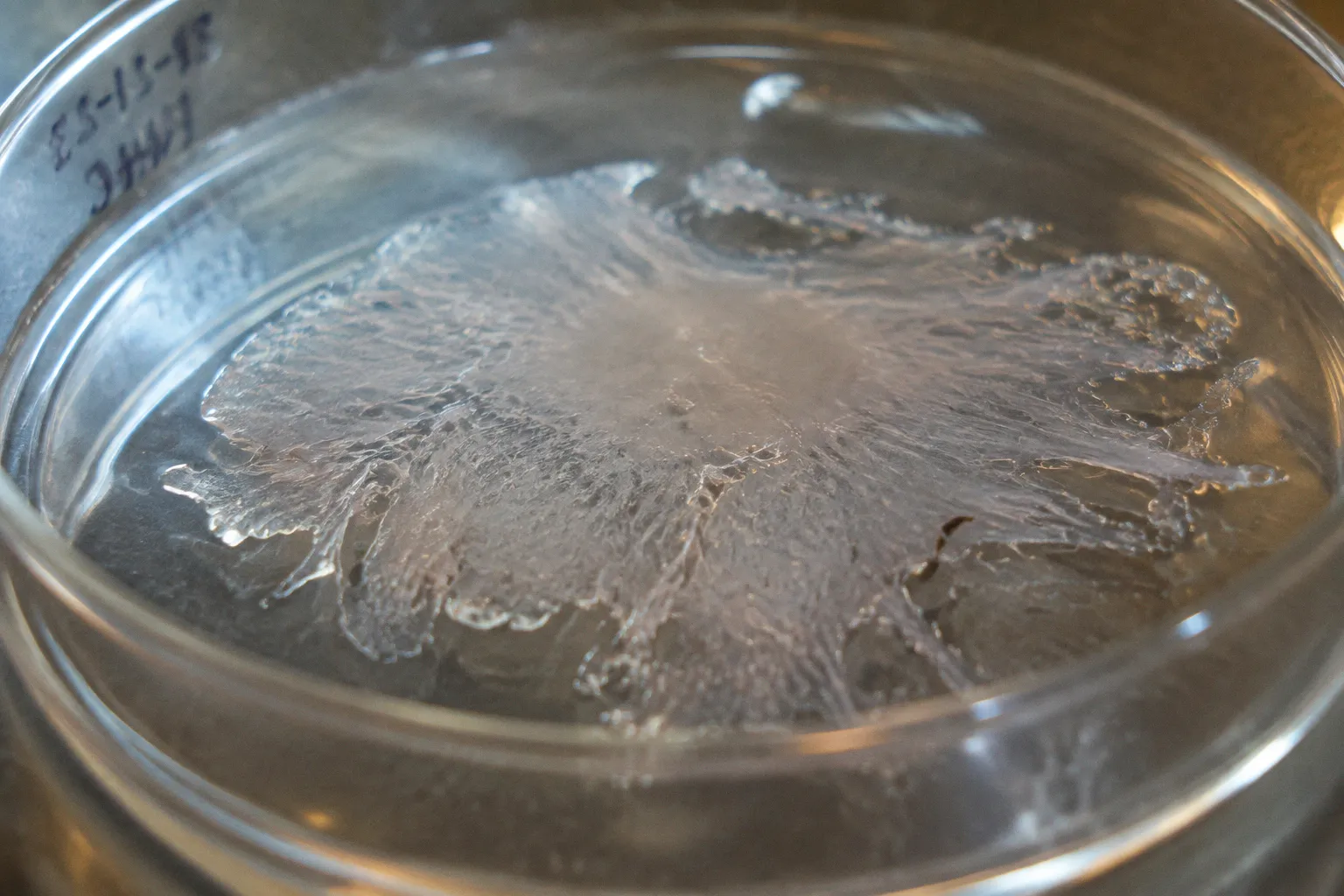 Primary RPE Isolation: A Case in Enzyme Overdigestion